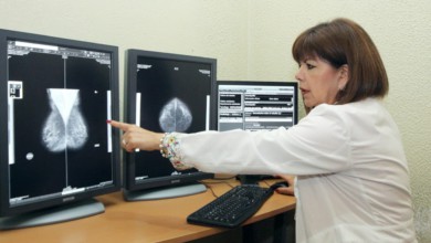 En su etapa inicial el cáncer de mama no presenta signos ni síntomas