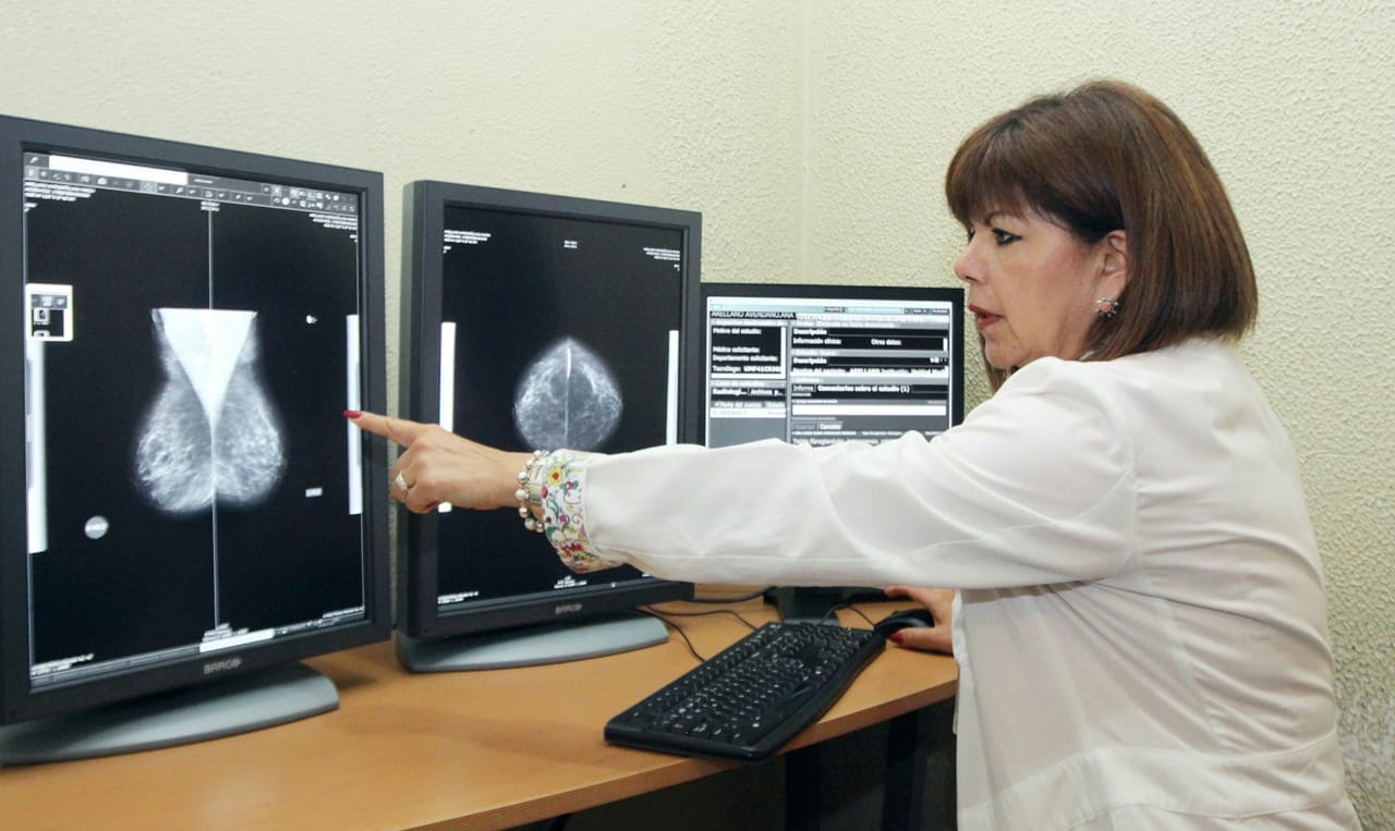 En su etapa inicial el cáncer de mama no presenta signos ni síntomas